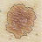 Skin Cancer Image Viewer 1.2