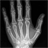 X-Ray Droid 1.2.1