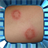 Ringworm Home Treatment Naturally icon