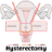 Hysterectomy icon