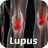 Lupus Symptoms Disease icon