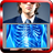 X-ray Mobile Scan APK Download